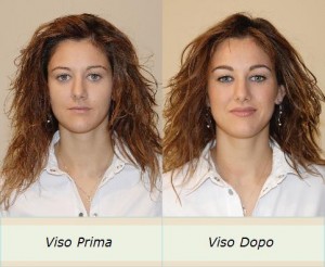 visoprimadopo